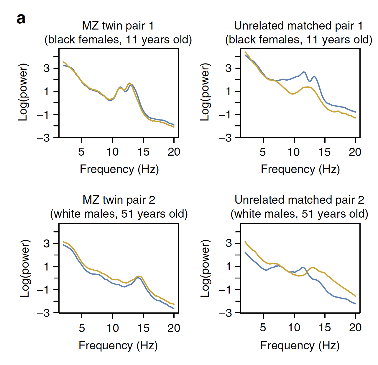 Sleep spindles / power spectra figure